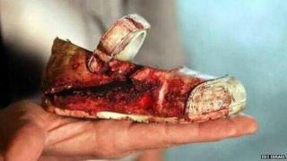 bloody shoe