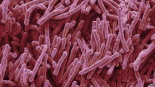 Bacteria