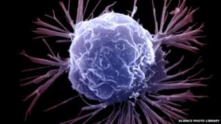 Breast cancer cell