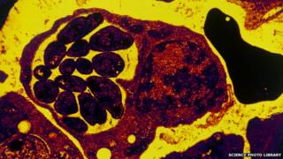 Red blood cell with malaria parasite