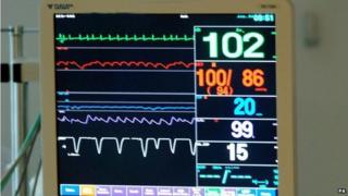 Intensive care monitor