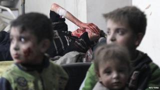 Injured children rest in a field hospital near Damascus on January 25, 2015