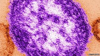 In this handout from the Centers for Disease Control and Prevention (CDC), a thin-section transmission electron micrograph (TEM) reveales the ultrastructural appearance of a single virus particle, or "virion", of measles virus. in this undated image