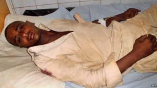 Рабочий, получивший ранения в результате нападения, получает медицинскую помощь в местной больнице в Турбате, провинция Белуджистан (11 апреля 2015 года)