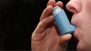 Asthma