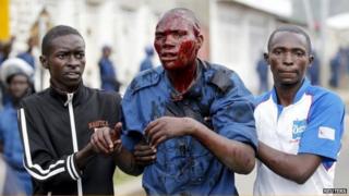 Injured protester in Bujumbura, Burundi on 27 April 2015