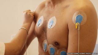 Heart screening includes looking at the electrical activity of the heart