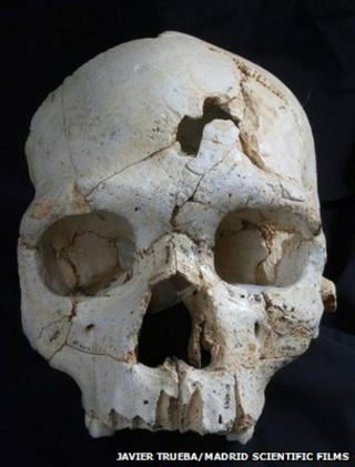 Frontal view of Cranium 17 showing the position of the two traumatic events