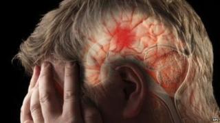 Man clutching head