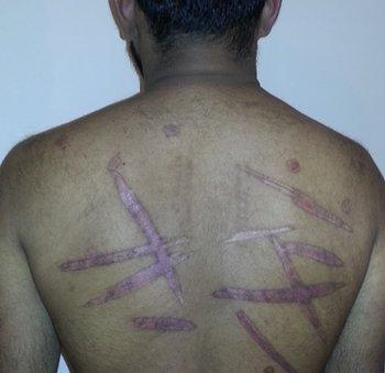 350px x 339px - Tamils still being raped and tortured' in Sri Lanka - BBC News