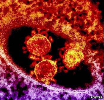 Particles of the Middle East respiratory syndrome (Mers) coronavirus