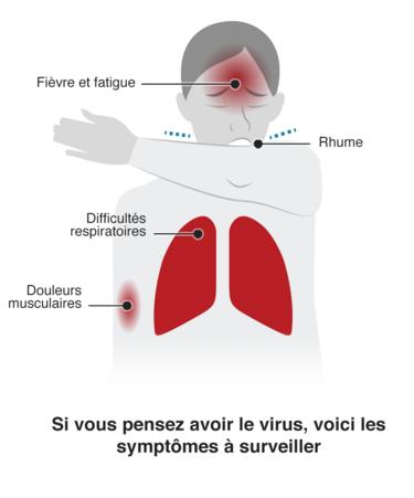 coronavirus