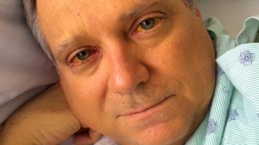Jim McCants på hospitalet
