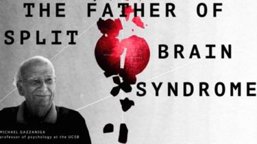 the father of split brain syndrome