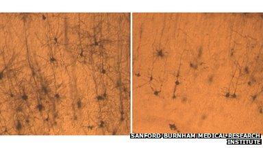 Neurons from a normal mouse (left) are longer and fuller than neurons from a mouse lacking SNX27 (right).
