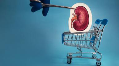 A cut-out drawing of a kidney in a supermarket trolley