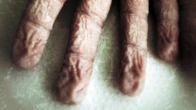 Fingers wrinkle in water