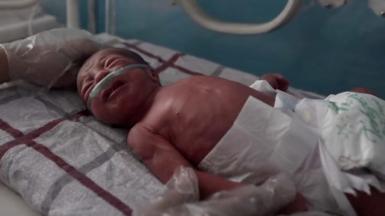 A premature baby boy delivered at 7 months