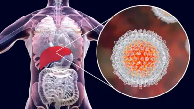 Ilustração mostra o fígado e uma visão aproximada dos vírus da hepatite C