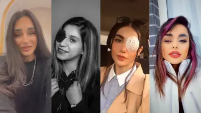 عکس دخترانی که آسیب چشمی دیده اند