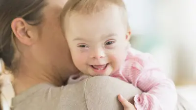 Un bebé con síndrome de Down sonriendo en brazos de una mujer