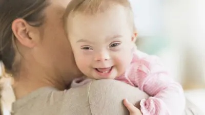 Bebê com Down no colo da mãe