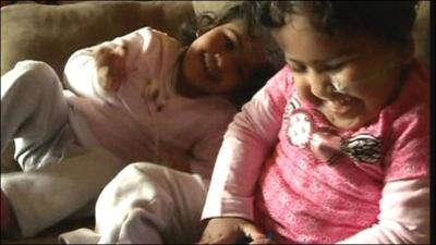 Formerly-conjoined twins Trishna and Krishna
