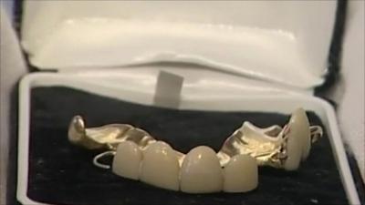 A set of Churchill's false teeth