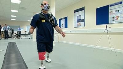 Leg amputee walking on prosthetic legs