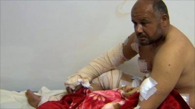 Injured Libyan