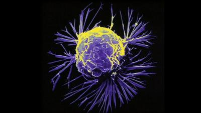 A magnified cancer cell