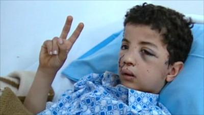 Injured boy in hospital bed in Benghazi