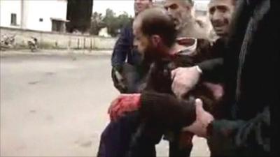 Am vid of injured Syrian man