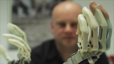 The BBC's Neil Bowdler with two bionic hands