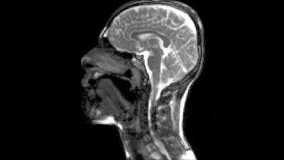 MRI scan of beatboxer performing