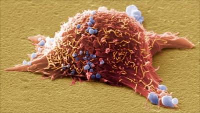 Skin cancer cell