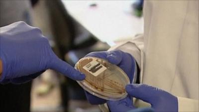 E .coli being examined