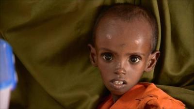 Child in Kenyan refugee camp