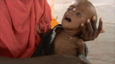 Child in Dadaab refugee camp