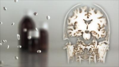 Graphic of brain and pills