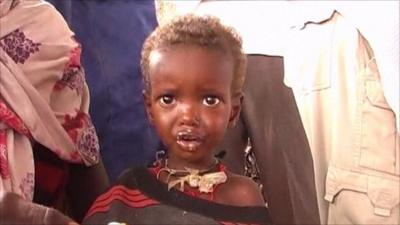 child in Somalia