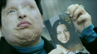 Ameneh Bahrami holding a photo of herself before the acid attack