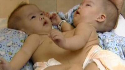 The twin girls were born in late April weighing 4.89 kg between them