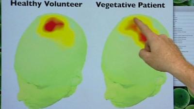 Measuring consciousness