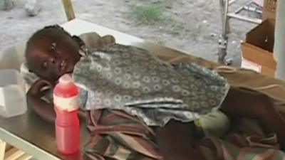 A young girl with cholera