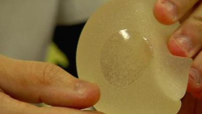 A breast implant