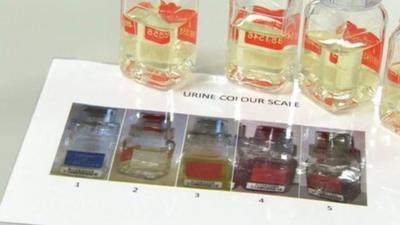 Testing urine colour