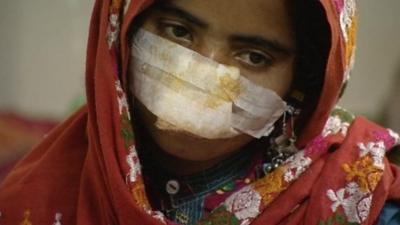 Victim of domestic violence in Pakistan.