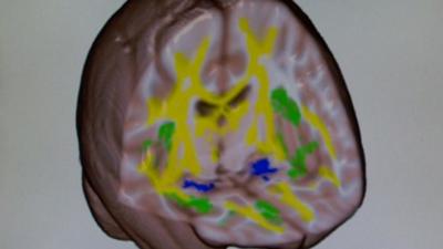 Image from brain scan