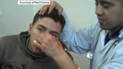 A man being treated in a clinic in Homs